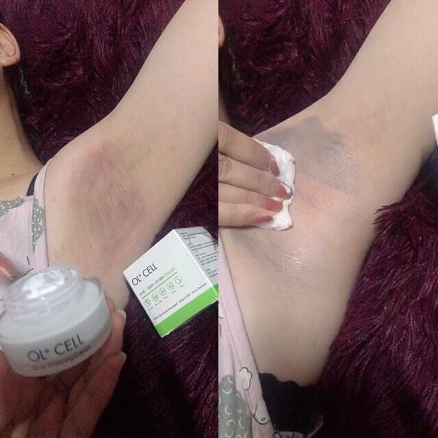 [CHÍNH HÃNG] Kem Trị Thâm Nách Thâm Môi Thâm Đầu Gối OL-CELL