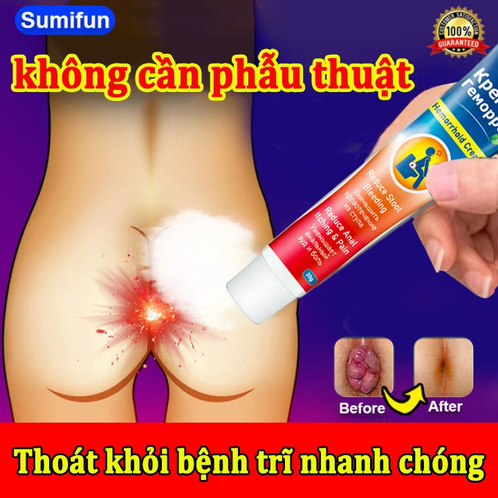 Kem bôi trĩ sumifun kem bôi teo búi trĩ co búi trĩ giảm đau ngứa vùng hậu môn giảm đau rát và làm co búi trĩ hiệu quả làm co mô sưng trĩ loại bỏ cơn đau do trĩ kem bôi trĩ 20g