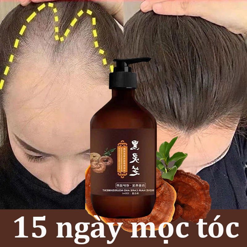 Dầu gội dầu gội mọc tóc Linh chi đen 300ml giảm rụng tóc, giảm bạc tóc, kích thích mọc tóc, Dầu gội 