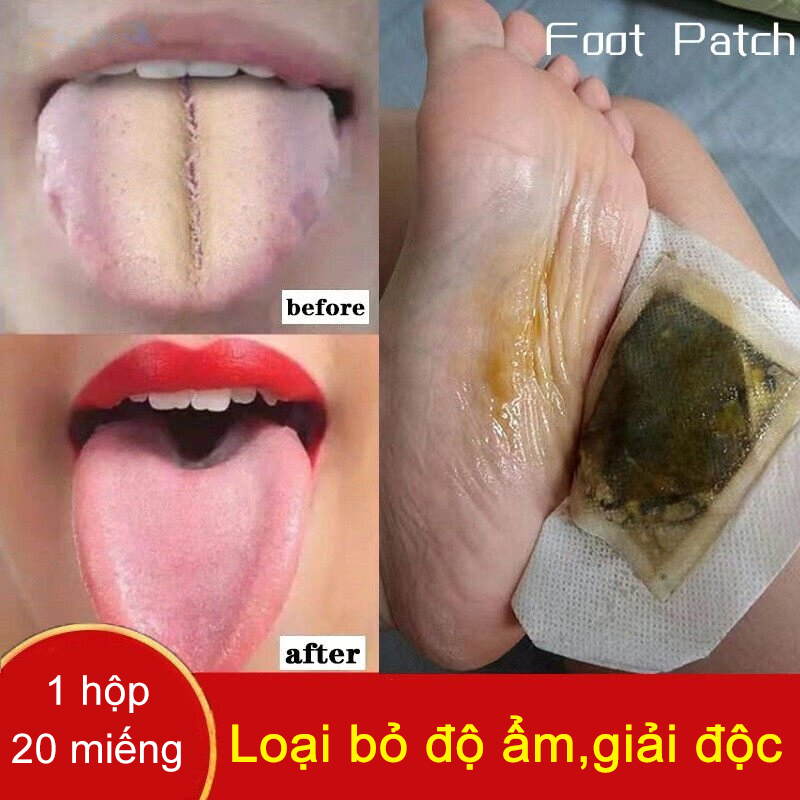 20 miếng dán thải độc chân nhật bản kinoki detox foot patch giúp thư giãn - ấm lòng bàn chân - giảm nhức mỏi，miếng dán thải độc bàn chân ngải cứu - món quà cho sức khoẻ