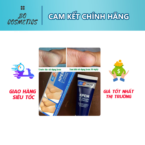 Kem Nứt Gót Chân Nga Kpem