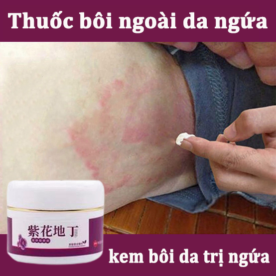 [Hiệu Quả Nhanh] Thuốc bôi ngoài da ngứa 30g Kem chống ngứa Kem eczema chống ngứa kem chống nấm vảy nên ngứa da kem chống nấm ngứa nhanh chóng giảm ngứa nhanh thuốc bôi nấm ngứa ngoài da