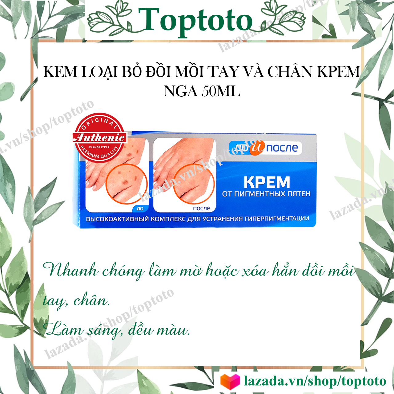 Kem đồi mồi tay chân kpem