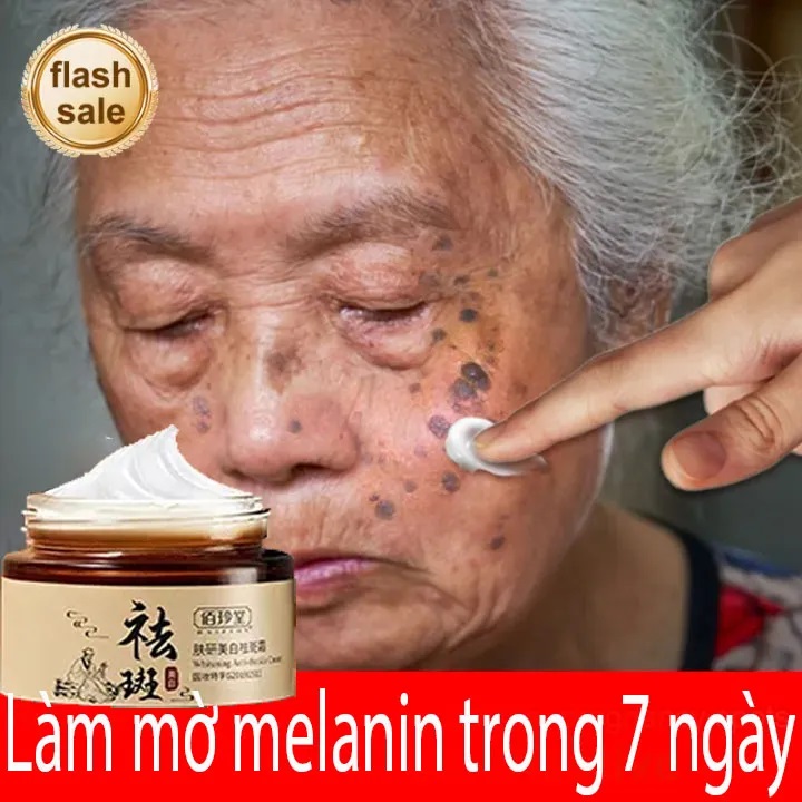 Kem xóa tàn nhang đồi mồi Kem Làm trắng Hot sale giảm giá Kem trắng da và xóa tàn nhang 30g Nám tàn nhang hiệu quả,Làm mờ thâm nám tàn nhan,kem thâm nám tàn nhang đồi mồi,Săn chắc da kem dưỡng ẩm cho mặt