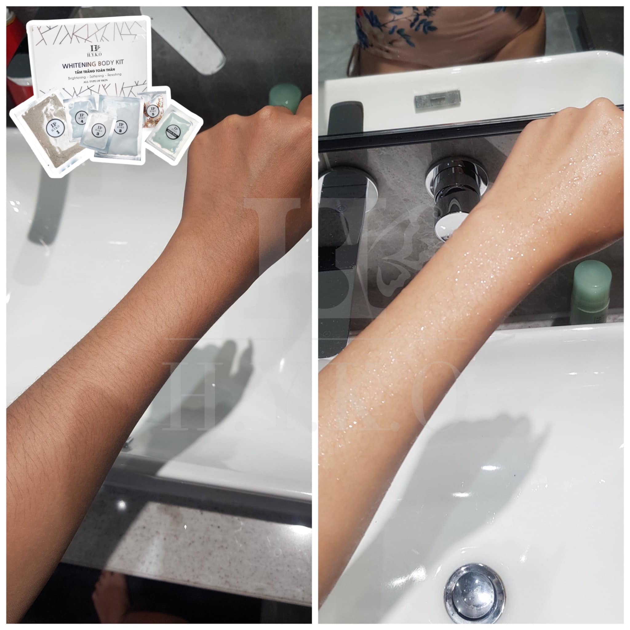 Set tắm trắng body hyko