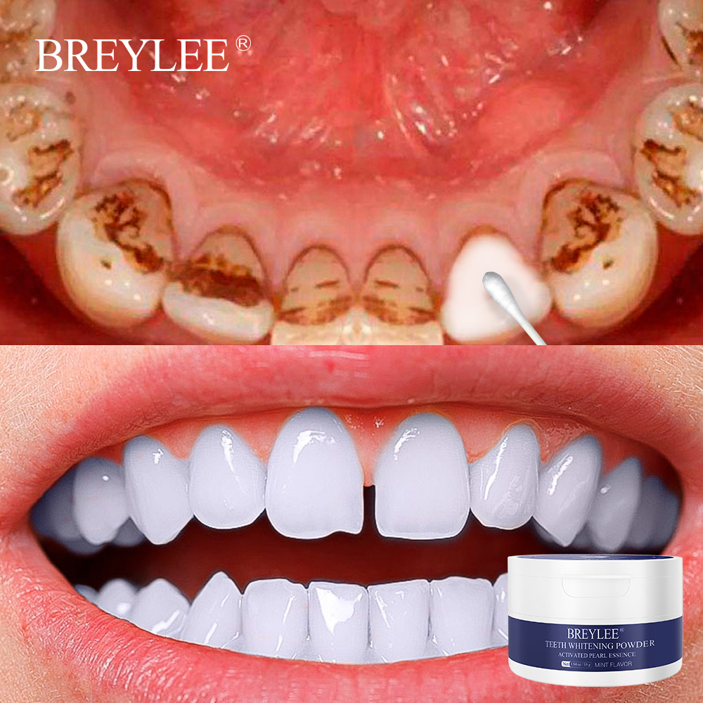 BREYLEE Hộp 55g bột tẩy trắng răng thích hợp khi dùng với kem đánh răng - INTL