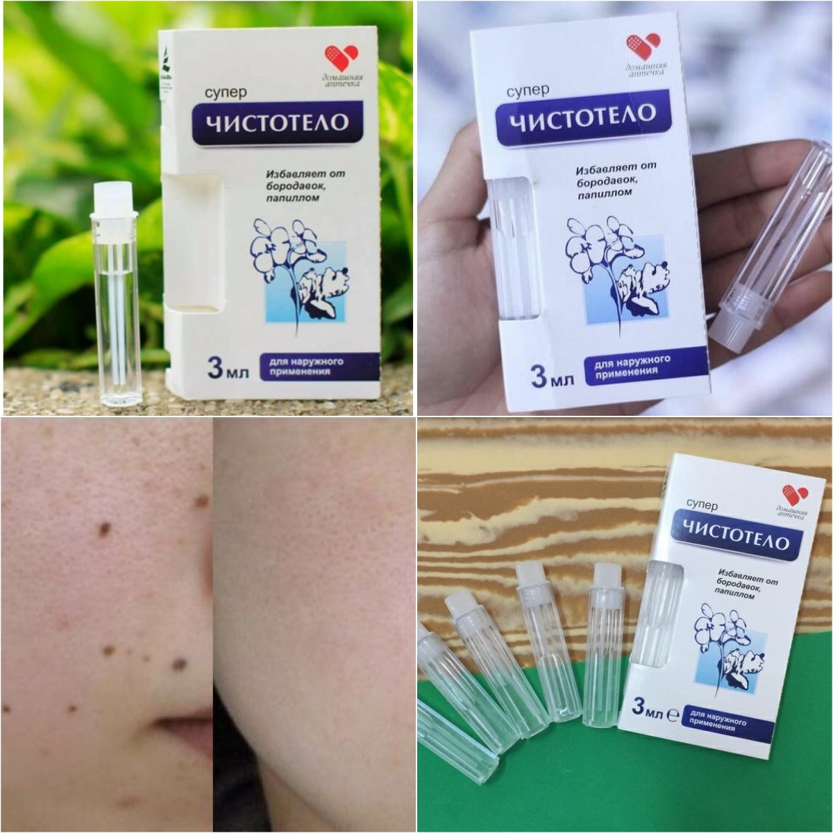 Gel chấm tẩy nốt ruồi, mụn cóc, tàn nhang DVELINIL của Nga