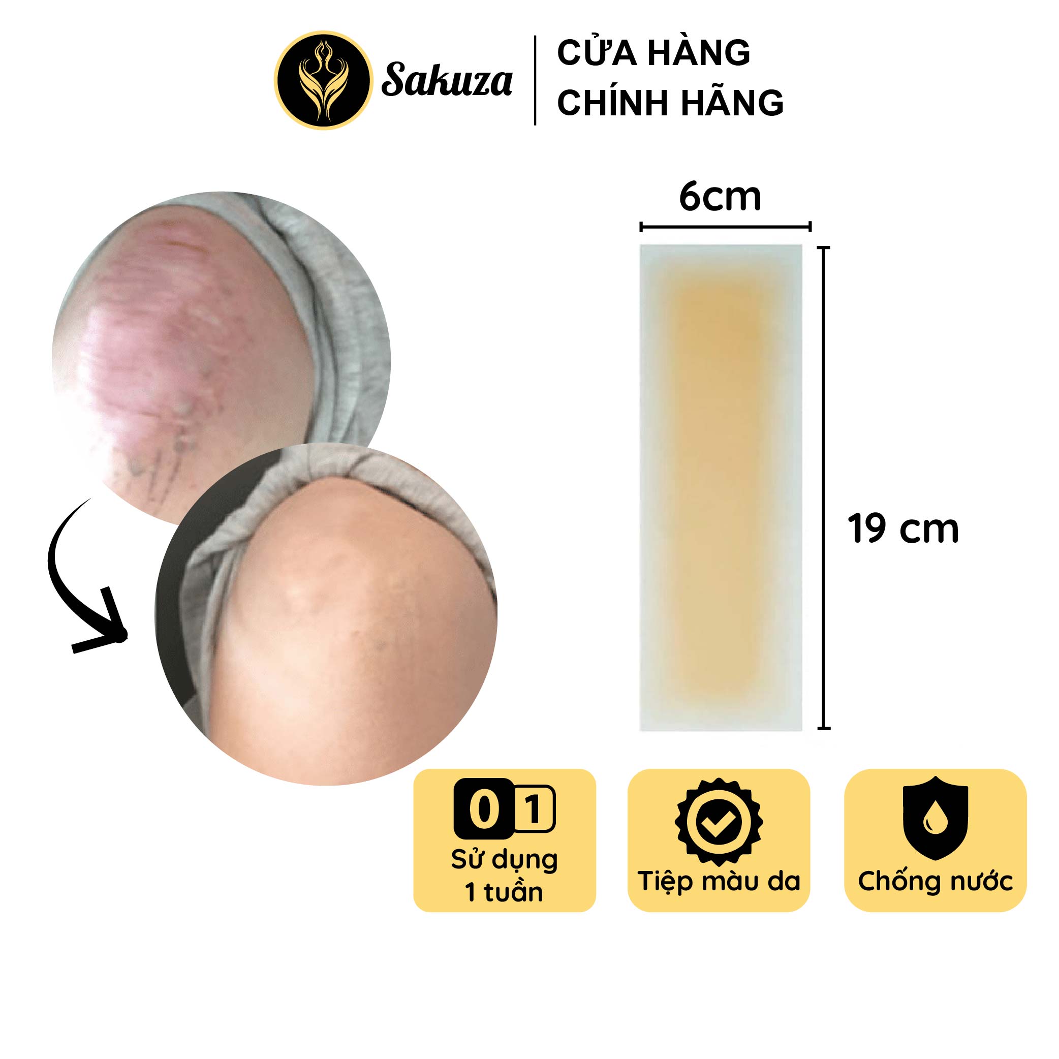 Combo 2 miếng dán che sẹo dài sẹo lồi Sakuza 6x19cm A1007