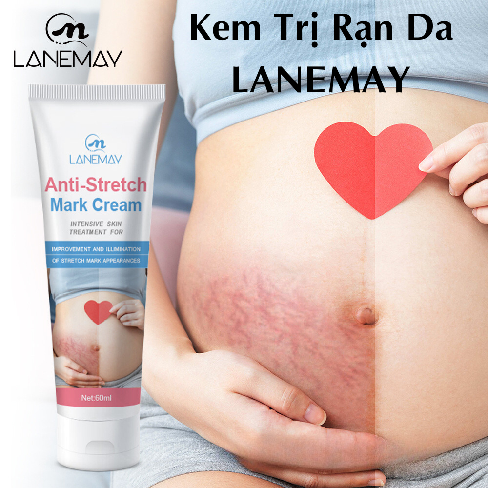  Kem Trị Rạn Da Làm Mờ Vết Rạn Dưỡng Ẩm Làm Mịn Da Không Gây Bết Dính An Toàn Tuyệt Đối Cho Mẹ Mang Thai 