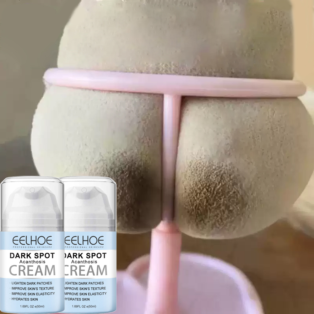 【HCM Kem dưỡng trắng da giảm thâm-VK Mông Đầu gối Khuỷu tay Cổ-nách khử mùi hôi nách làm trắng da