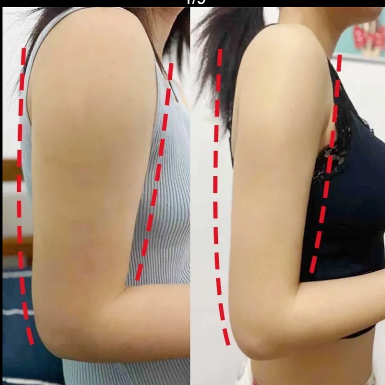 Giảm cân thần tốc trong 7 ngày Miếng dán thon người giảm cân, đốt mỡ 10pcs Slim Slimming Patch， Belly button stickers，Diet Weight Loss Detox Adhesive Pads， lazy people quietly stick to belly
