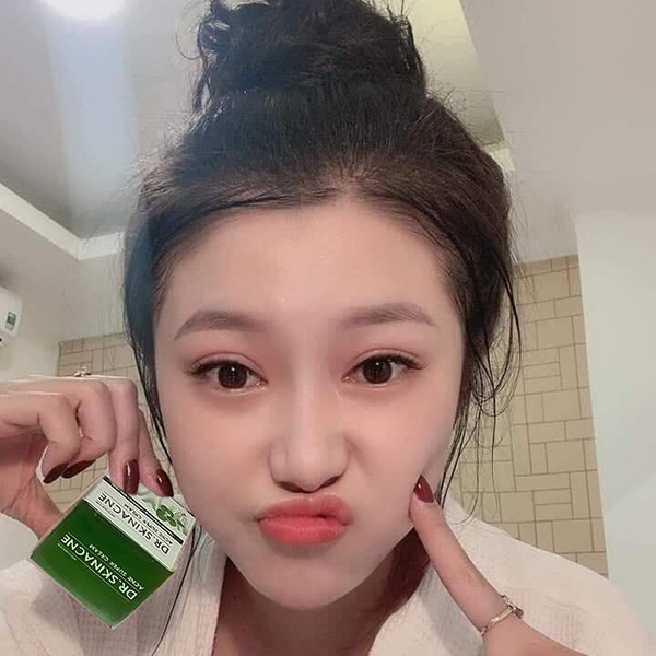 kem Loại Bỏ Mụn bọc,mụn đâu đen,mụn trứng cá giải tỏa mong muốn sạch mụn