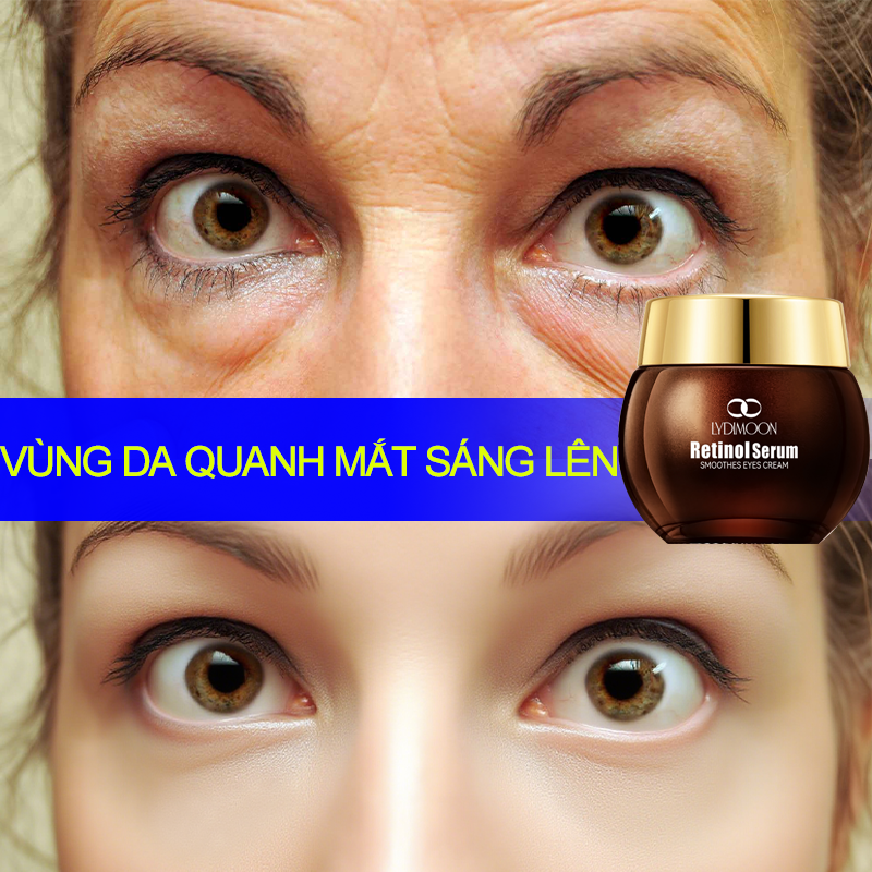 [Hàng Chính hãng] Kem mắt chống lão hóa, giảm nếp nhăn vết chân chim, loại bỏ mụn hạt mỡ, xóa quầng thâm, làm dịu da mắt, giảm sưng, loại bỏ bọng mắt, cải thiện bọng mắt ,làm săn chắc da 35g