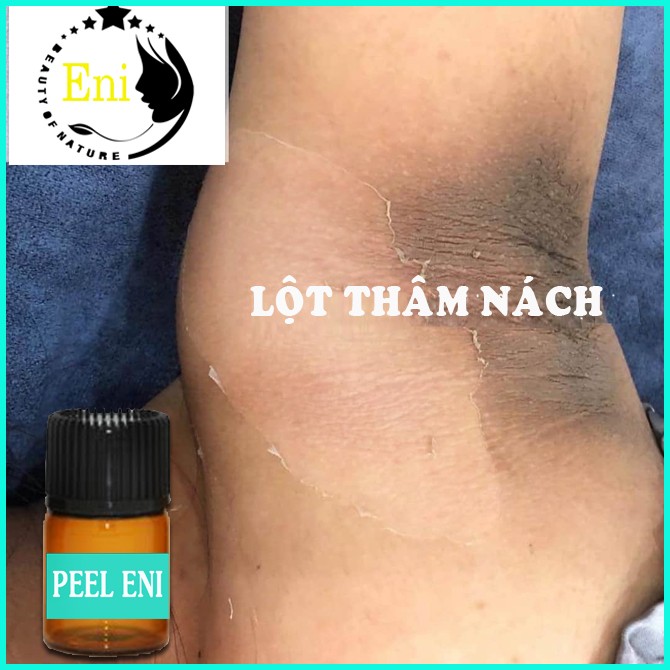 [HCM]Peel Lột Nách Trắng Da Xóa Thâm ENI