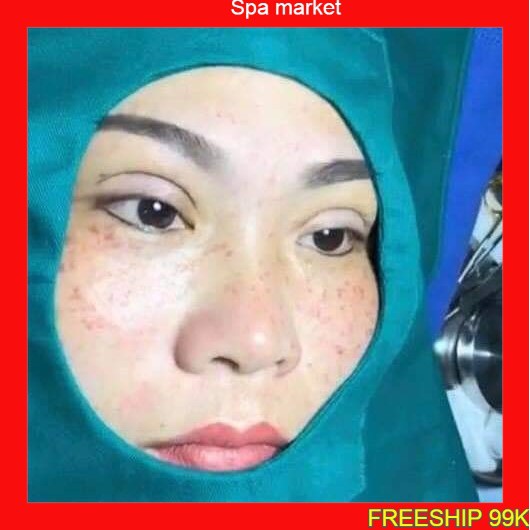 Săng che mặt Xăng che mặt dùng trong phẫu thuật Tấm che mặt dùng trong spa và TMV