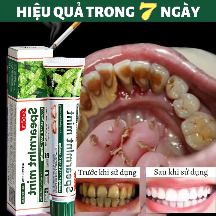 Kem đánh răng 100g Hương bạc hàkem đánh trắng răng giảm ố vàng hết hôi miệng dạng gel lỏng thơm đánh răng làm trắng răng Khử hôi miệng tẩy trắng răng Giảm sâu răng kem đánh rặng loại bỏ mảng bám vết bẩn giảm ê buốt răng
