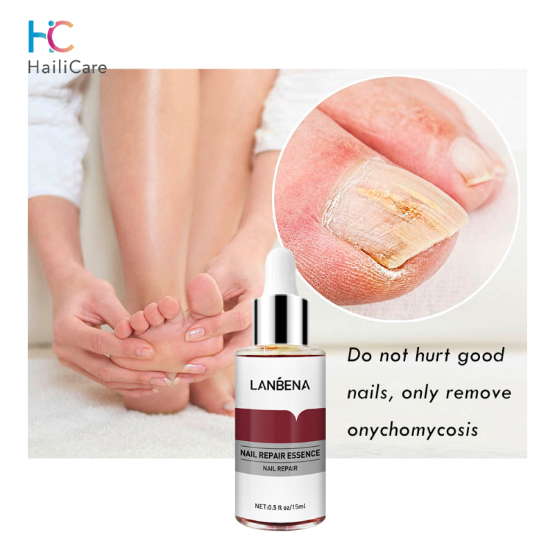 Hailicare tinh chất phục hồi móng tay dung dịch trị nấm móng chống nấm chăm sóc da chân tay 12ml