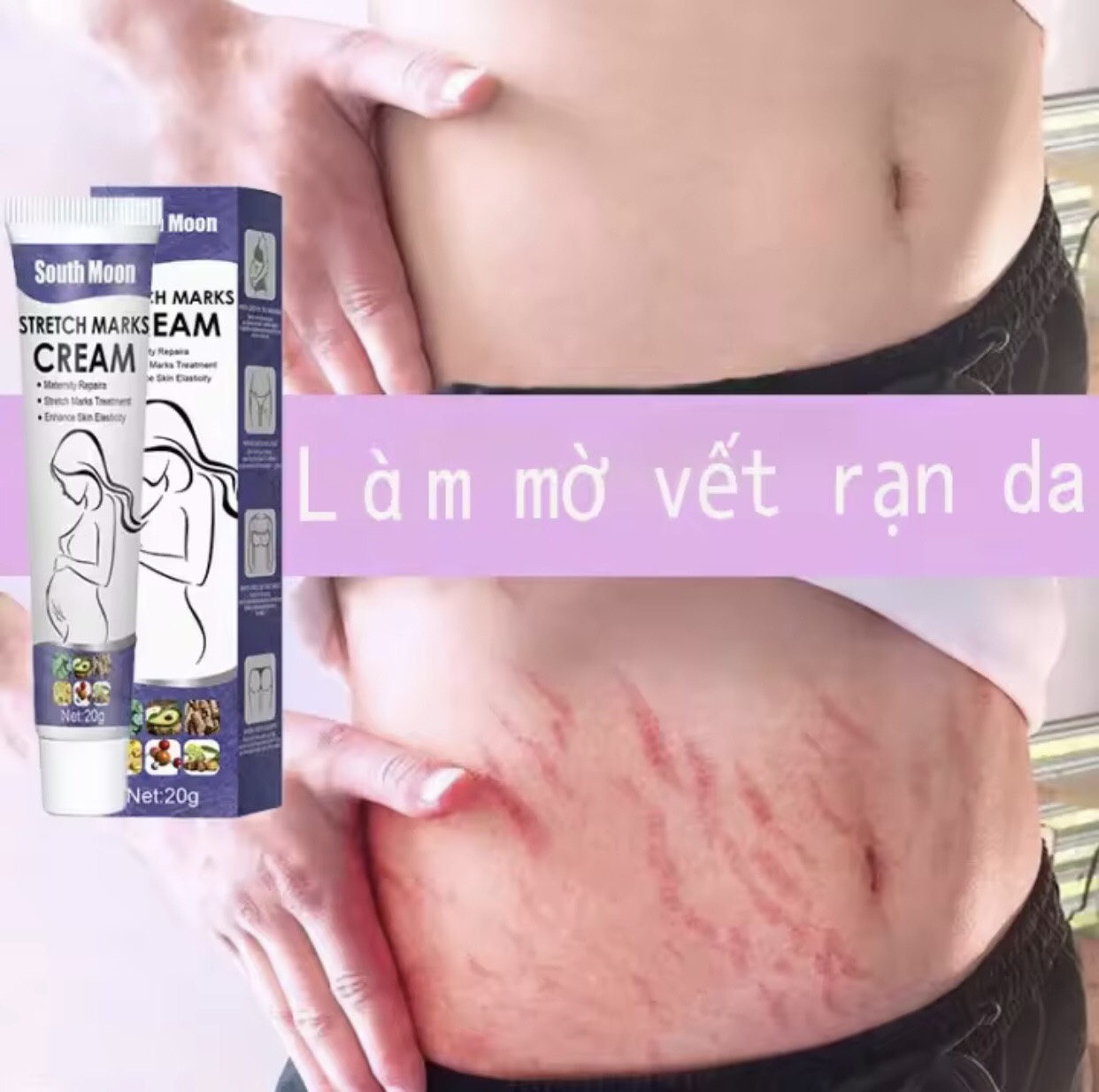 Kem rạn da, kem giảm rạn da sau sinh, kem south moon
