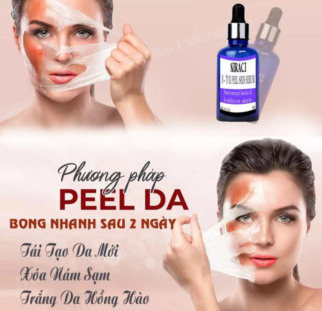 Feel Thay da Xóa Nám Niraci của Hàn Quốc