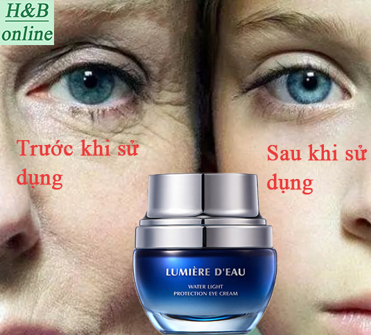 Kem mắt kem mắt chống lão hóa Loại bỏ quầng thâm mắt Kem dưỡng ẩm vùng mắt kem chống nhăn 30g loại bỏ bọng mắt nâng cơ làm săn chắc xóa mờ nếp nhăn chống lão hóa phù thũng