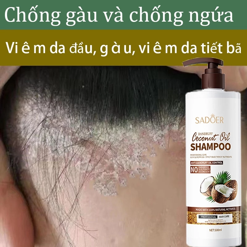 dừa dầu gội chống gàu dầu gội chống ngứa dầu gội nấm da 500ml phục hồi nang tóc da đầu nuôi dưỡng tóc kiểm soát dầu