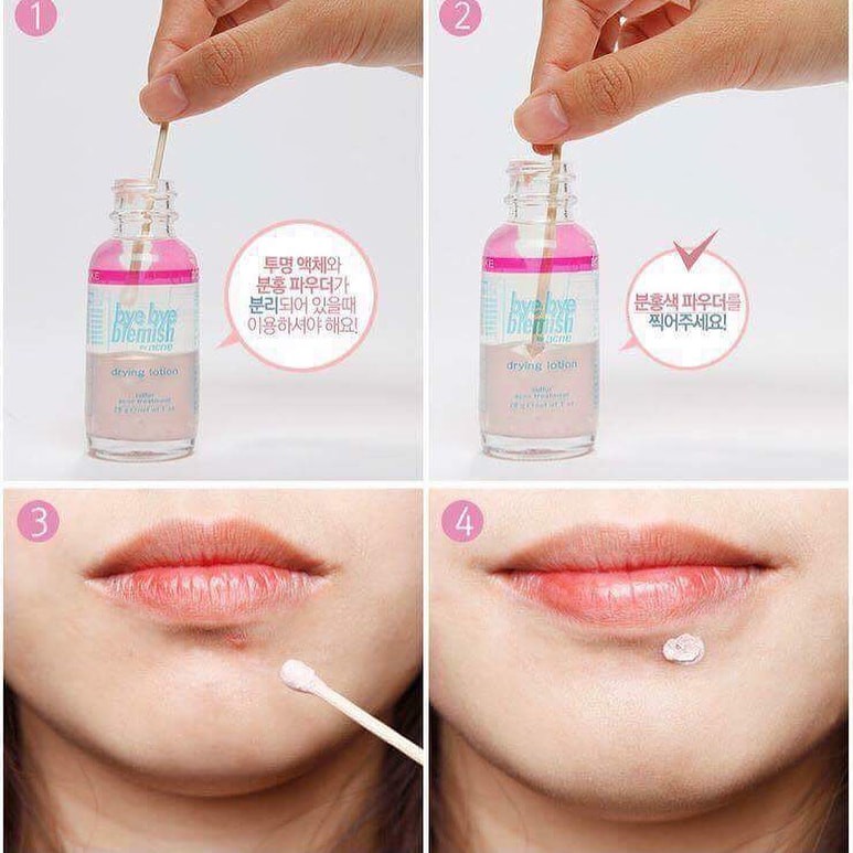 Chấm mụn khẩn cấp Bye bye blemish