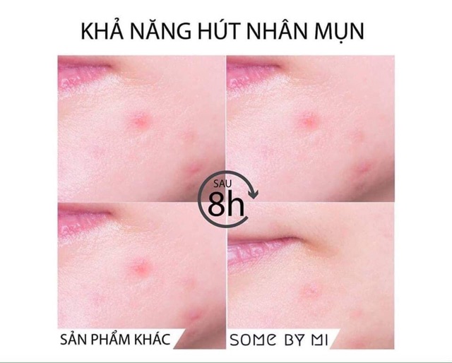 Miếng dán mụn some by mi 30 days miracle clear spot patch