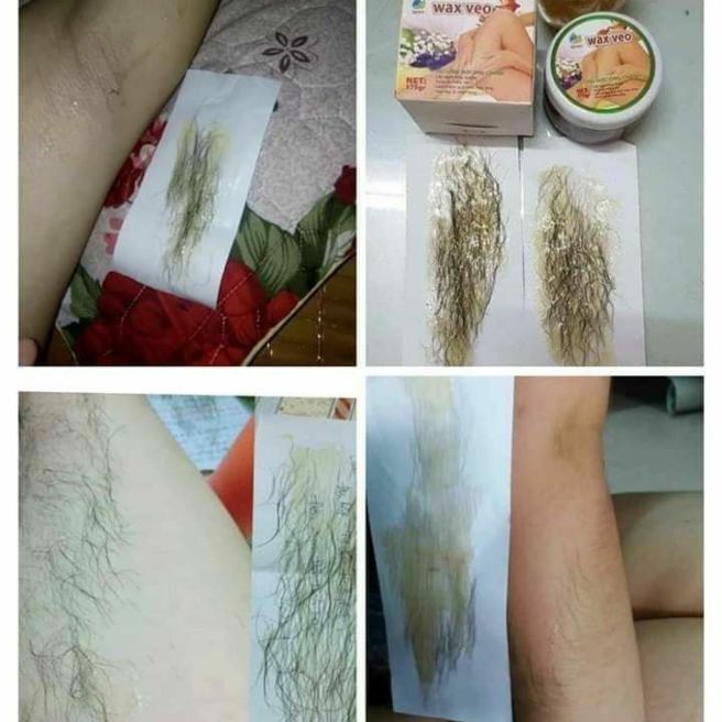 [FreeshipMAX] was vèo triệt lông vĩnh viễn lông nách, lông chân ,lông tay, dâu ria....(tặng giấy và que gạt) .