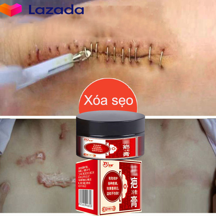 (Kem xóa sẹo mạnh mẽ 7 ngày) xóa sẹo chuyên nghiệp do ngã, sẹo sau phẫu thuật, vết trầy xước, vết bỏng và vết thâm, Giảm thâm nám, dưỡng ẩm cho da,hiệu quả nhanh chóng
