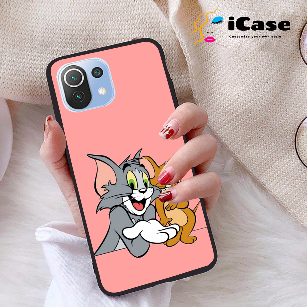 Ốp lưng xiaomi mi 11 lite 5g viền dẻo tpu bst pinky