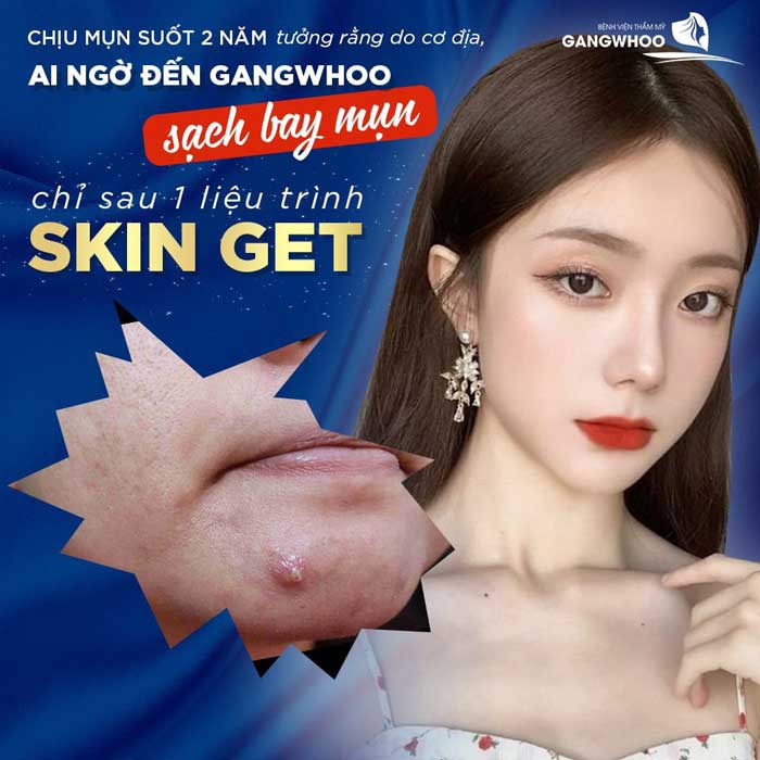 Công nghệ “kép” phục hồi da toàn diện –DUAL Perfect Skin tại Gangwhoo