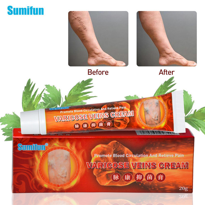 Kem bôi suy giãn tĩnh mạch giảm đau nhức cơ, chuột rút, giảm vết bầm tím, gân xanh nội địa Trung Hoa