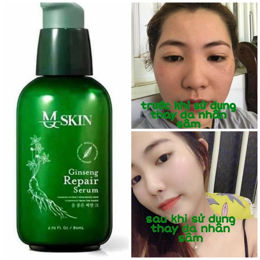 [HCM]Serum tái tạo da MQ Skin