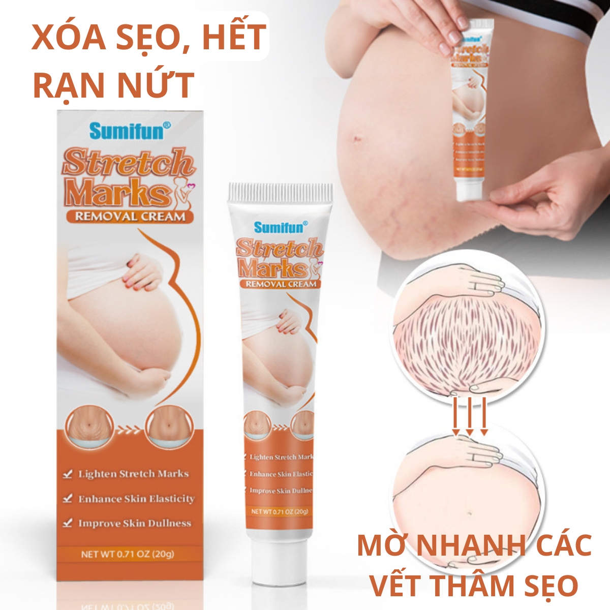 Kem Hết Rạn Da Cho Các Mẹ Bầu Mờ Dần Sẹo Nhanh Chóng Lấy Lại Tự Tin Với Làn Da Trắng Mịn