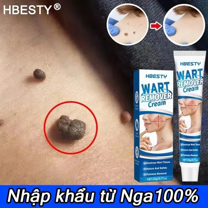 Kem Rụng Mụn Thịt Dư, Mụn Cóc HBESTY WART REMOVER CREAM