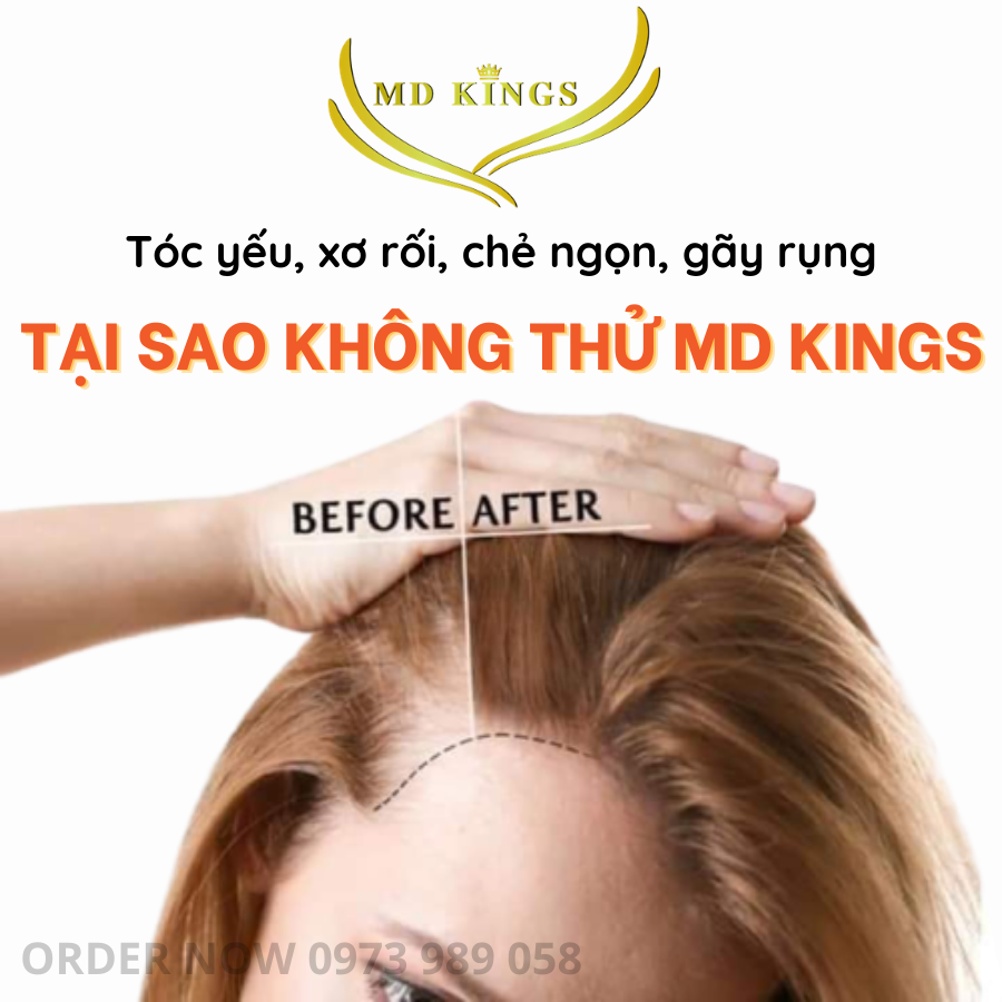 Dầu gội thảo mộc MD KINGS 300ml - gội xả 2in1 chống rụng tóc, hỗ trợ mọc tóc, sạch bay gàu