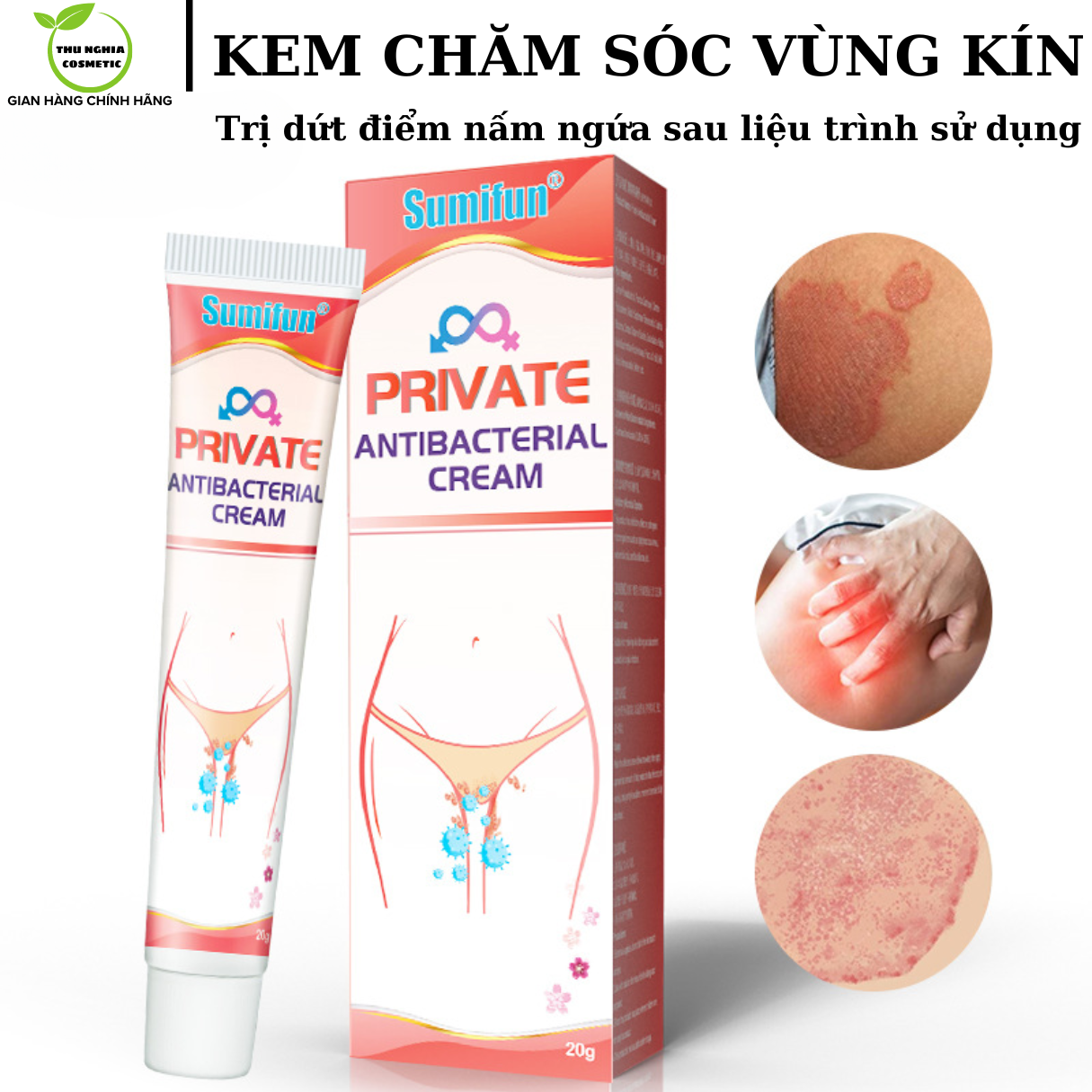 Kem Bôi Hết Sạch Nấm Ngứa Vùng Kín Cho Nữ Giới Và Cả Nam Giới Chỉ Sau Vài Ngày Dứt Điểm