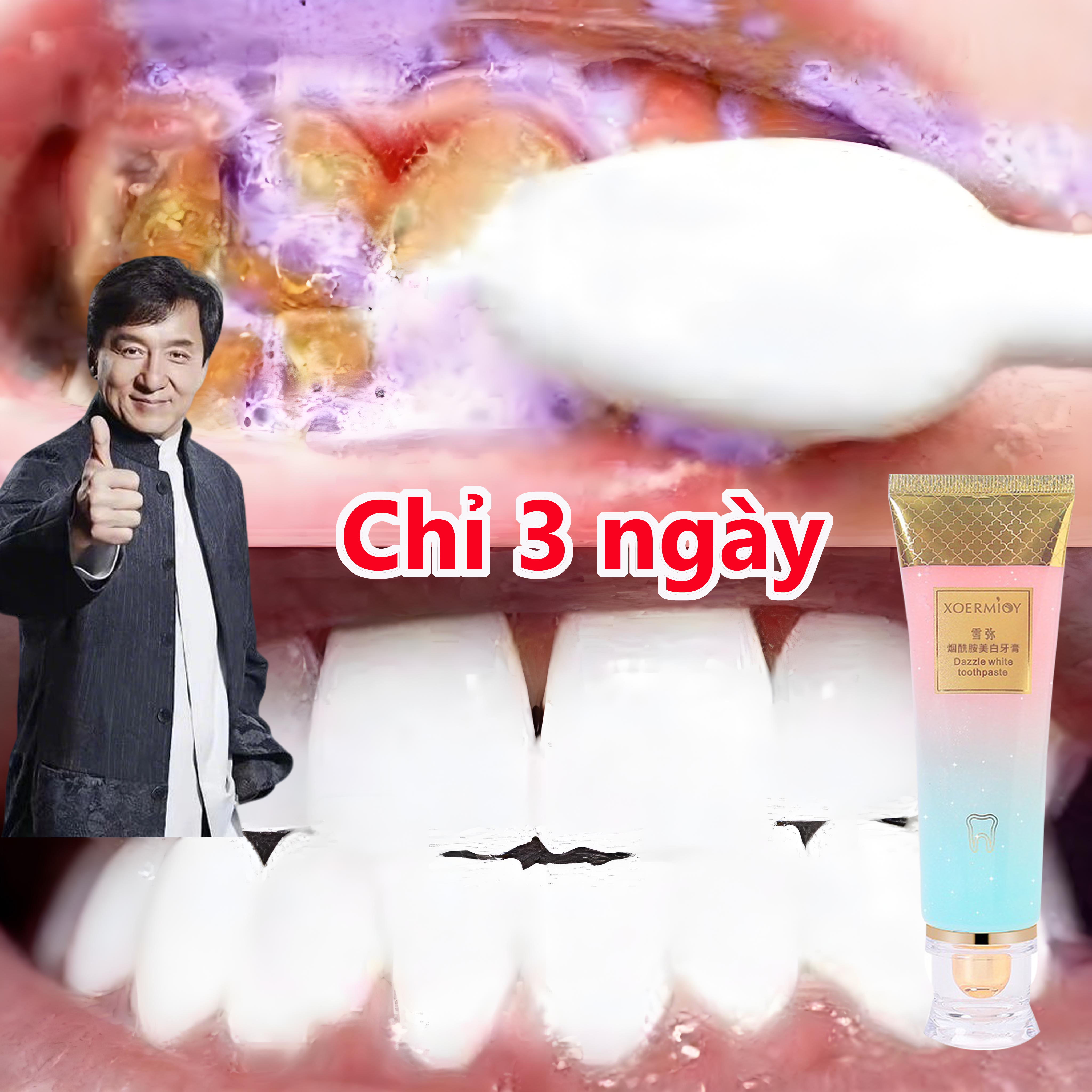 100g Kem đánh răng làm trắng răng: Làm sạch răng, loại bỏ mảng bám, làm trắng răng, ngăn ngừa sâu răng và loại bỏ răng ố vàng