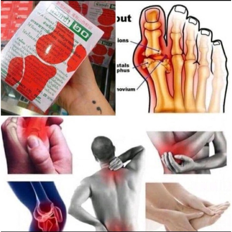 Lốc 12 hộp xương khớp noxa 20 Thái Lan