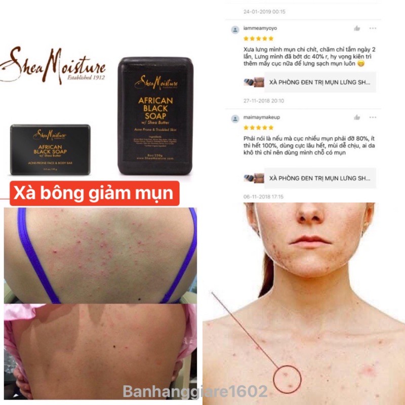 Xà phòng đen ngăn ngừa - giảm mụn lưng shea moisture african black soap 230gr