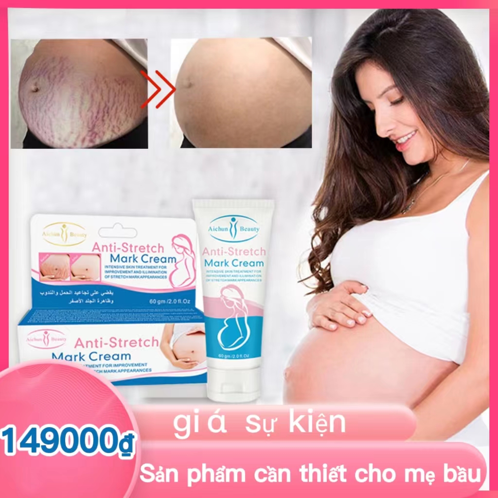 Kem rạn da Kem xóa nhăn Kem loại bỏ sẹo Làm mờ vết rạn sau sinh Kem làm săn chắc da cho bà bầu,Aichun body lotion 60g kem dưỡng da xóa rạn da Kem phục hồi vết rạn da làm mờ nếp nhăn