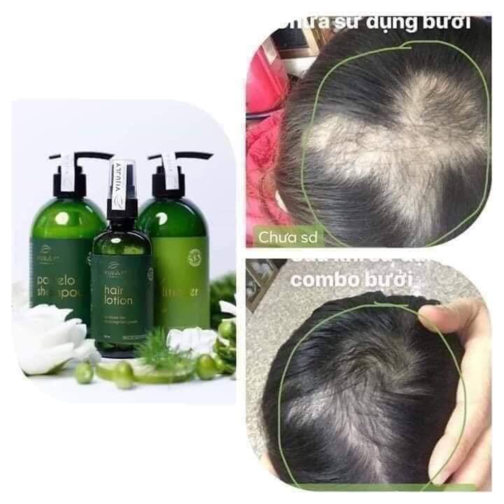 Combo Dầu Gội- Xả- Xịt BƯỞI VIJULY HẾT LO RỤNG TÓC -KÍCH THÍCH MỌC TÓC, PHỤC HỒI TÓC KHÔ XƠ HƯ TỔN