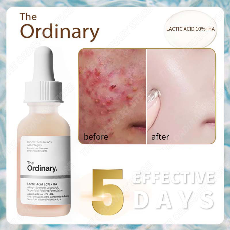 The ordinary serum sáng da giảm thâm lactic acid 10% + ha the ordinary tẩy da chết mụn đầu đen tinh chất mực toner
