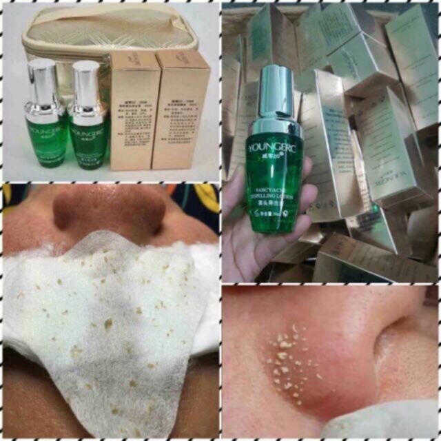 Ủ mụn youngerc chính hãng chuyên dùng cho spa tmv