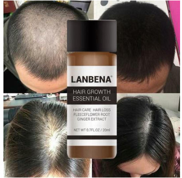 Dung dịch kích thích mọc tóc lanbena dưỡng tóc chuyên sâu tóc mọc nhanh giảm gãy rụng chai 20ml