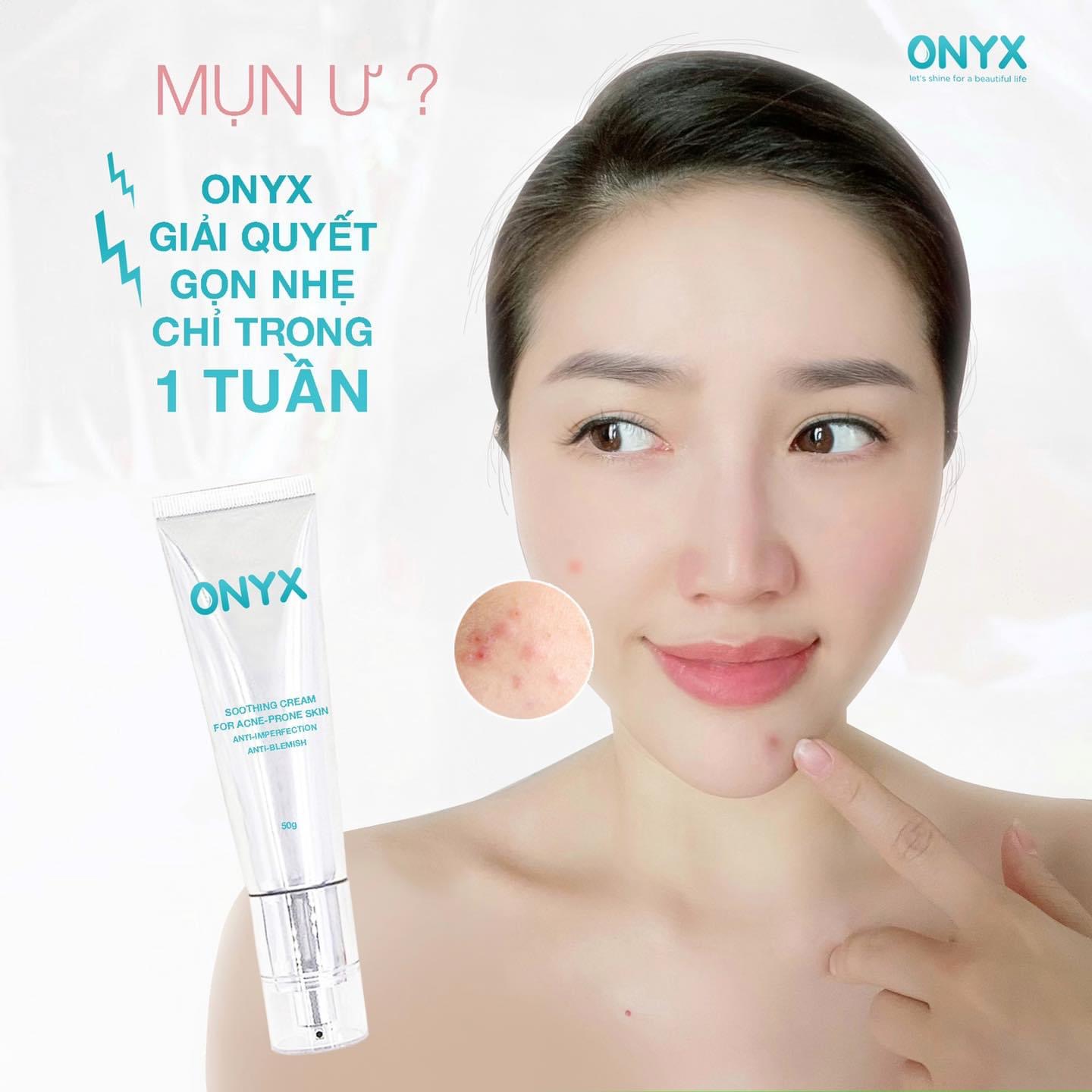 Kem dưỡng dành cho da dầu mụn nhạy cảm Soothing Cream ONYX giúp dưỡng ẩm làm thông thoáng lỗ chân lông và ngăn ngừa mụn 50g