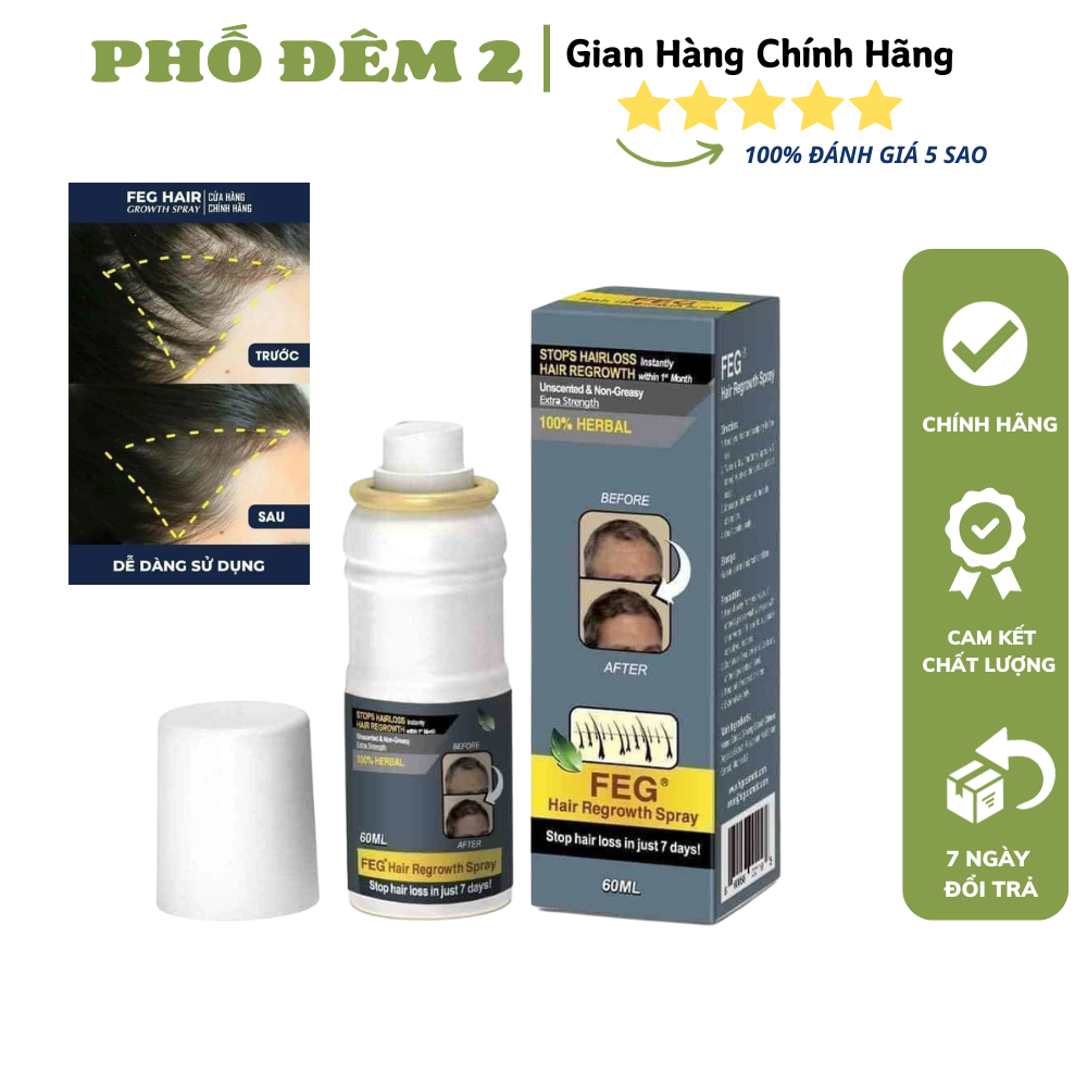 [HCM]CHAI XỊT KÍCH MỌC TÓC DÀY CHO NAM VÀ NỮ