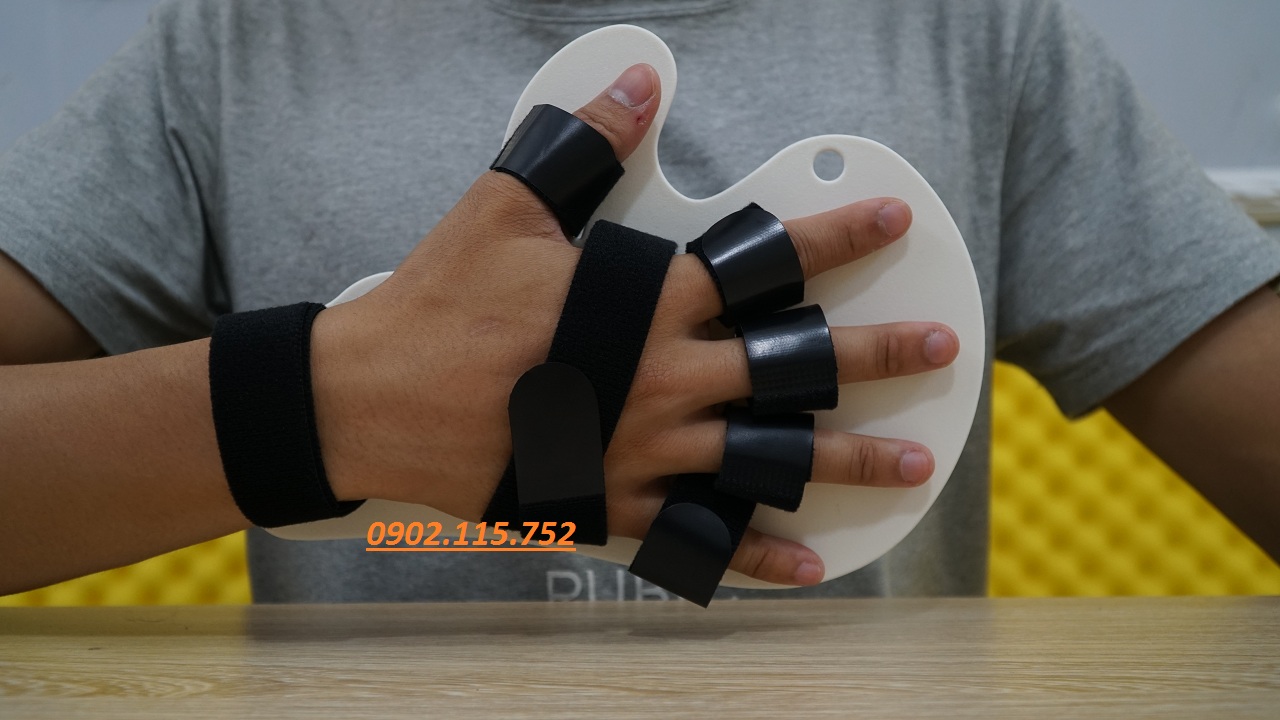 Nẹp cố định bàn ngón tay