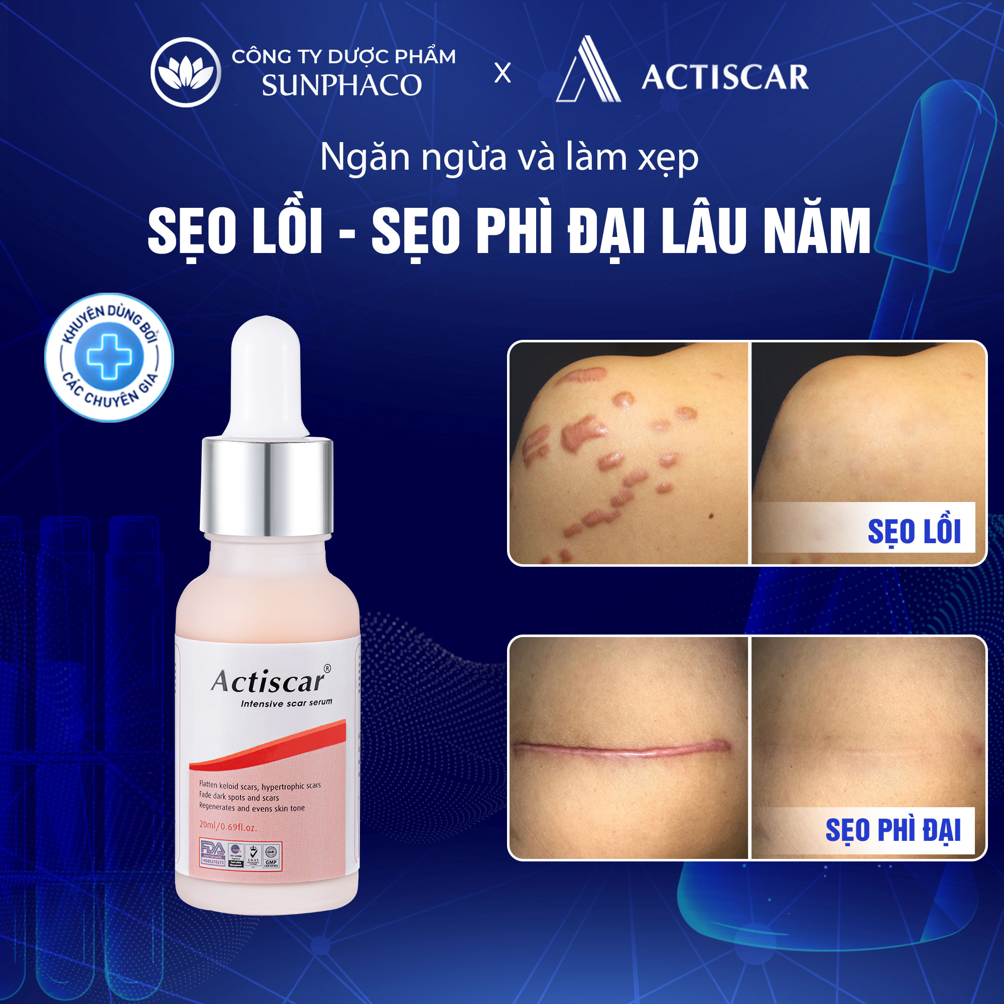 Serum sẹo lồi, sẹo phì đại chuyên sâu actiscar làm phẳng và làm mờ sẹo 20ml