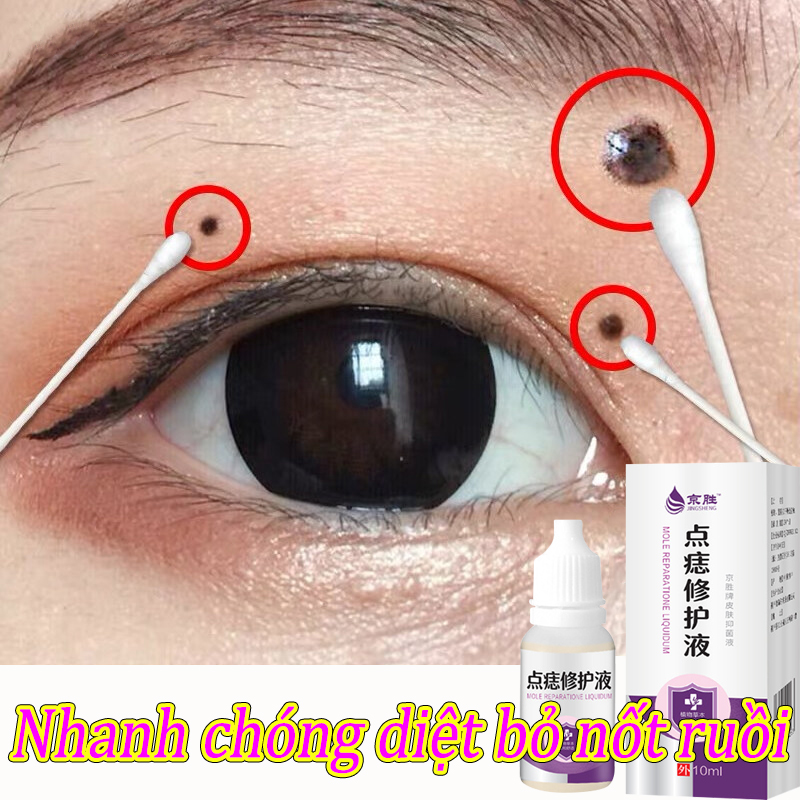 Serum xóa nốt ruồi Kem xóa nốt ruồi xóa mụn cóc Kem xóa nốt ruồi nhanh chóng Tẩy nốt ruồi trên mặt không đau Tẩy tàn nhang Kem thuốc mỡ làm phẳng mụn cơm nốt ruồi lồi Phục hồi vùng mặt